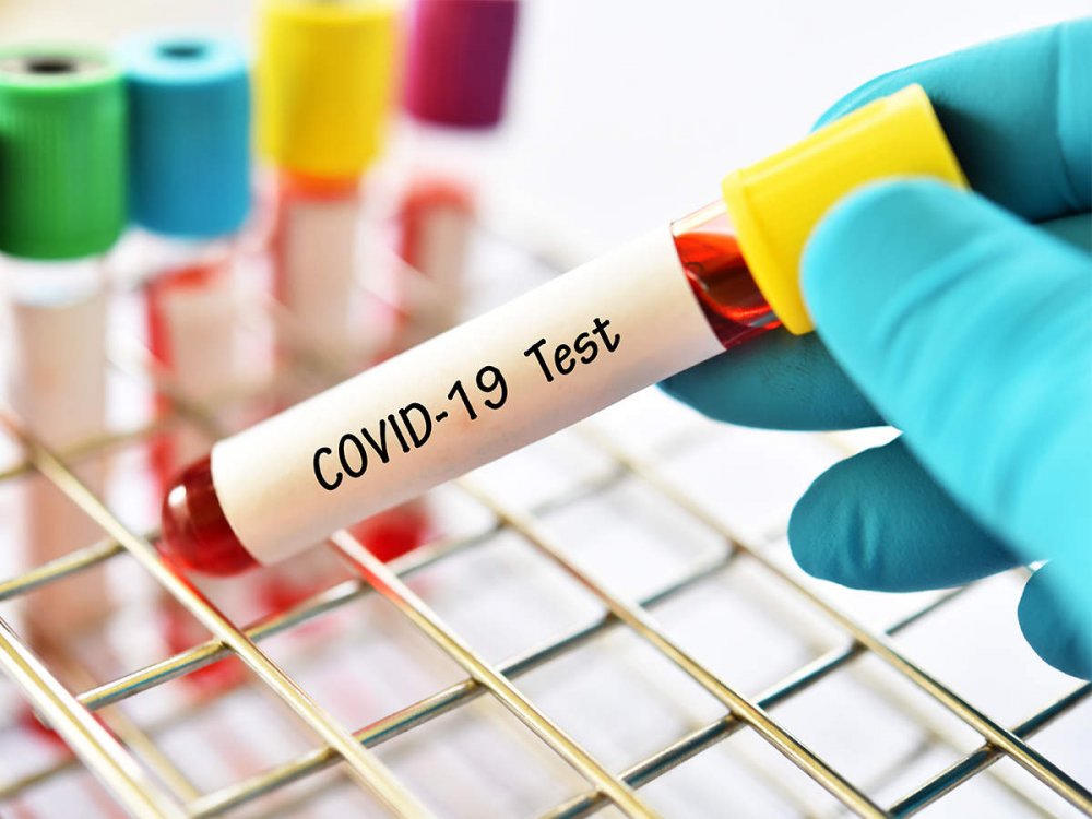 Situația actualizată privind COVID-19 la Constanța. Au fost confirmate 1.543 de persoane infectate - 1-1598458969.jpg