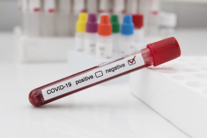 Test negativ de coronavirus, necesar pentru românii care intră în Egipt - 1-1598630426.jpg