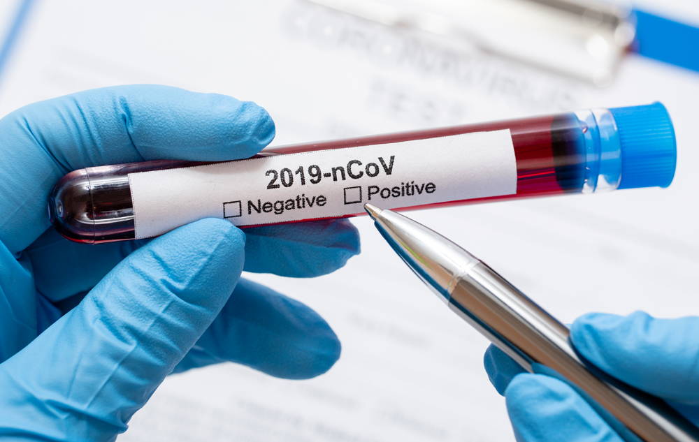 Coronavirus la Constanţa. 4.404 de persoane au fost confirmate cu COVID până în prezent - 1-1603211578.jpg