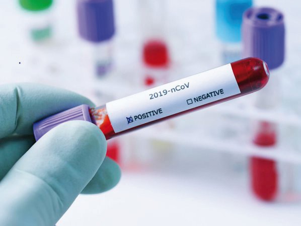 Coronavirus la Constanța. 21.283 de persoane au fost infectate cu COVID până în prezent - 12pozatestcovidjos-1607624221.jpg