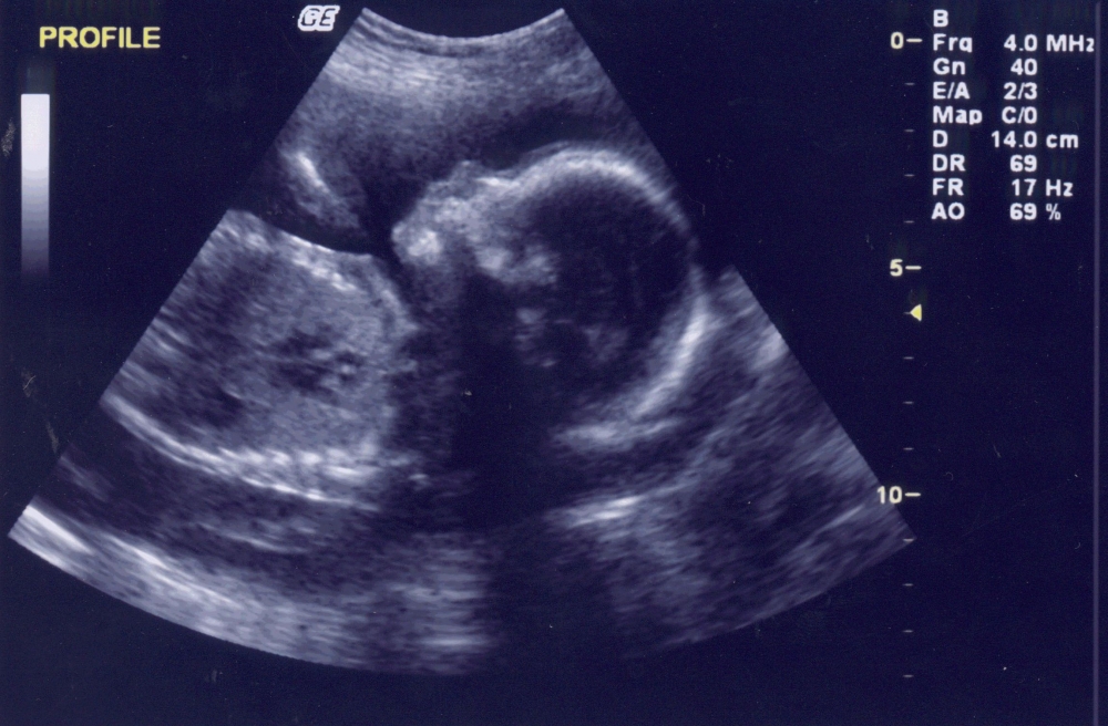 Curs despre ecografia fetală, în Constanța - 13martieisiscurseducatiemedicala-1394713221.jpg