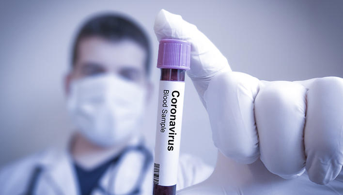 Coronavirus la Constanța. Până la această oră 1.182 de persoane au fost confirmate cu COVID-19 - 25cumgestionampotentialelecazuri-1597074973.jpg