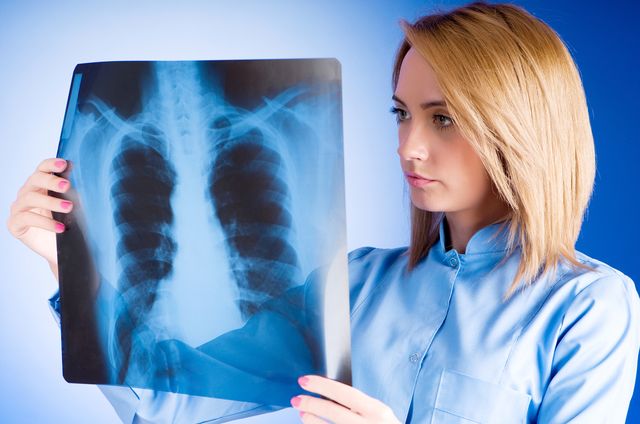 Nefumătorii prezintă risc foarte scăzut de cancer pulmonar - 324060l640x0w93cb44ed-1505212601.jpg