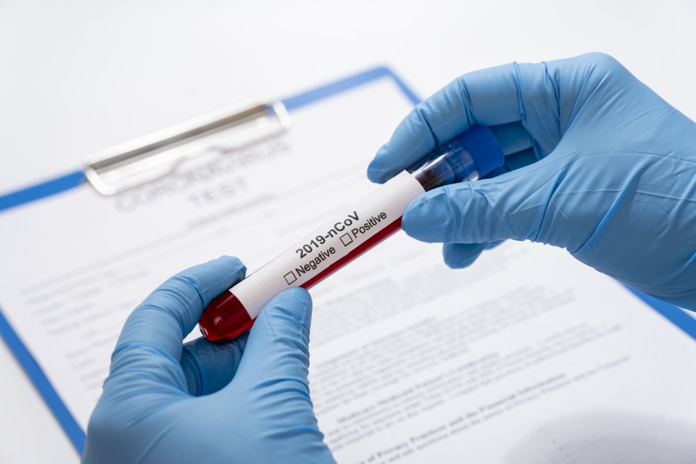 Câte teste pentru coronavirus au fost efectuate până acum în România - 3522834-1585840674.jpg