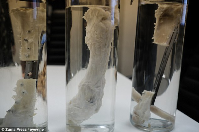 Fragment de os dezvoltat în laborator, implantat cu succes în tibia fracturată a unui bărbat - 48fda511000005780imagea115181128-1520504170.jpg