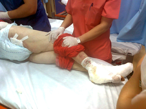 Pacienta cu răni până la os, plimbată cu ambulanța între spitale - 6db2fc94899203869ff00151f941dcff.jpg