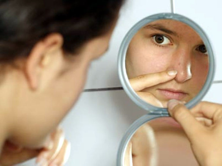 Cum tratăm un ten afectat de acnee - acnee-1353343981.jpg