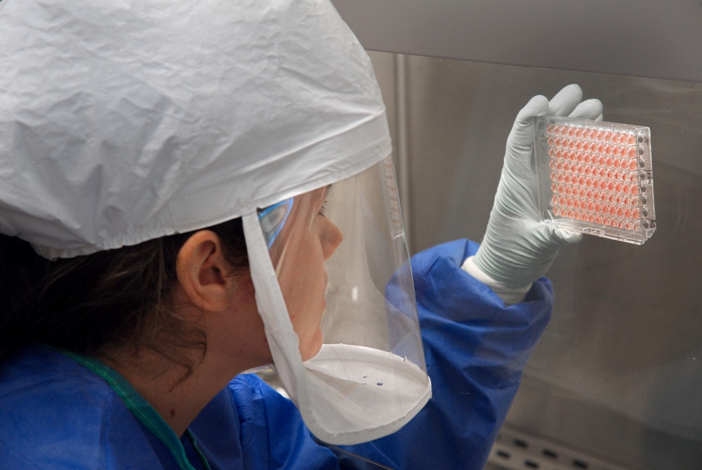 Veste bună! Un nou tip de anticorp împotriva virusului Ebola - analizelaborator-1412241710.jpg
