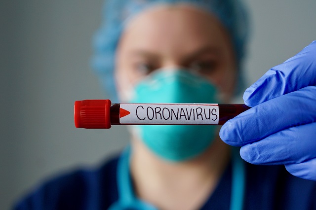 Încă 10 persoane infectate cu noul coronavirus au murit. Bilanțul GCS ajunge la 1.589 - b69ac57c4b0443118a49a3e3e23681cd-1593264047.jpg