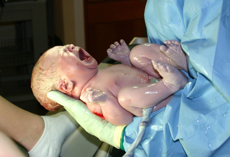 Șoc: un medic susține uciderea bebelușilor nedoriți sau cu handicapuri - bebelus-1330615545.jpg