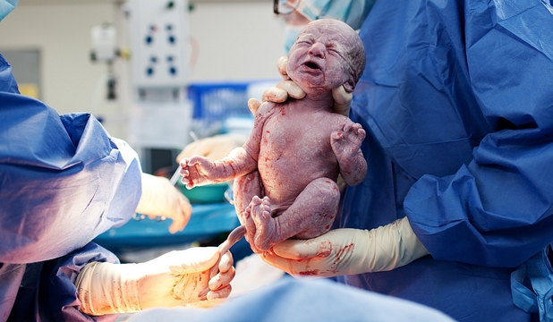 Ce le lipsește copiilor născuți prin cezariană? Cercetătorii au aflat răspunsul - bebelusnascut-1475160055.jpg