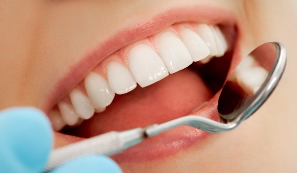 Cum vom putea preveni cariile dentare - carii-1319712415.jpg