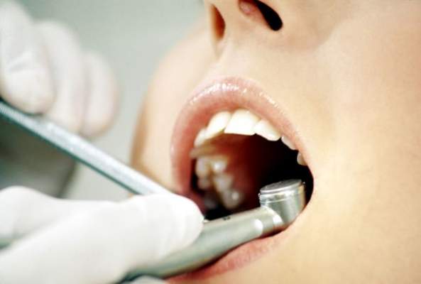 Cariile dentare, evitate cu un vaccin - carii-1319747638.jpg