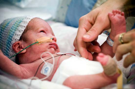 Ce șanse de supraviețuire au copiii născuți prematur la Constanța - copiiinascutiprematur-1394129053.jpg