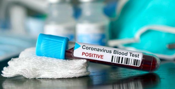 O nouă victimă a coronavirusului. S-a înregistrat decesul nr. 44 - corona-1585561140.jpg