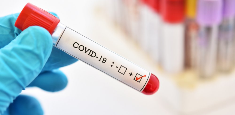 COVID-19. Numărul îmbolnăvirilor continuă să scadă, la Constanţa - coronaviruspositive8884161600257-1618395580.jpg