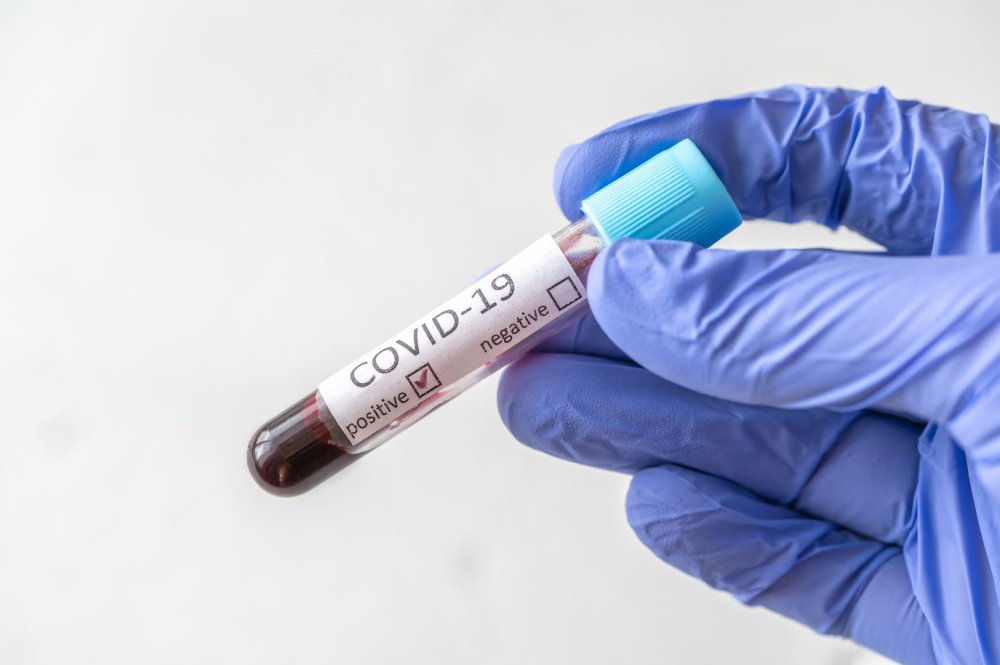 Trei noi simptome ale infectării cu COVID-19, recunoscute oficial de specialiști - covid-1593428351.jpg