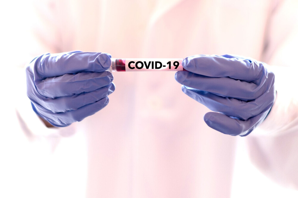 Situația COVID-19, la Constanța. 331 de teste, in 24 de ore - covid-1596915347.jpg