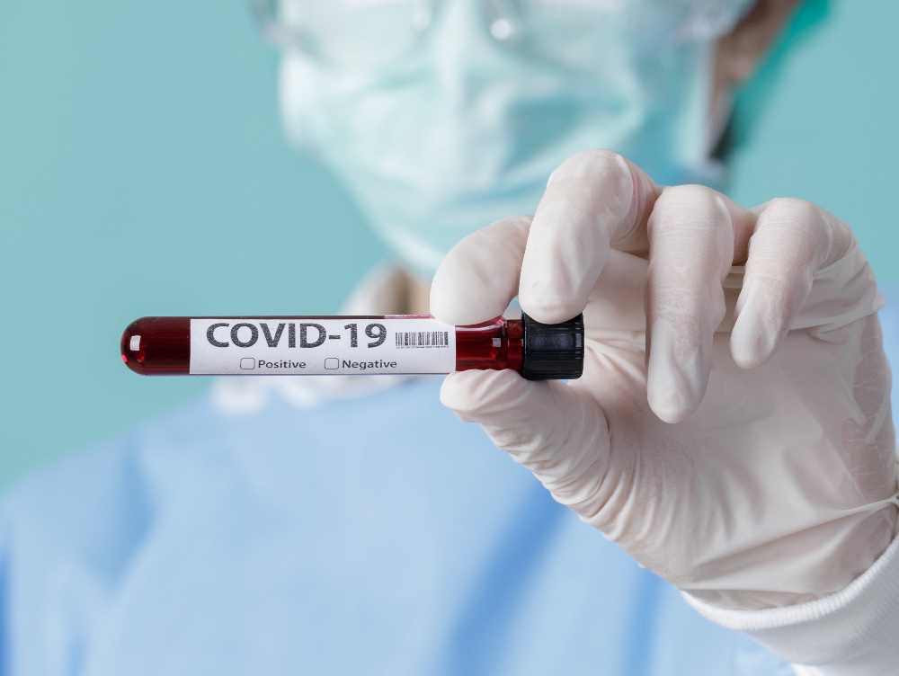 COVID-19. Creștere alarmantă a cazurilor de îmbolnăvire, în țară - covid191-1591870950.jpg