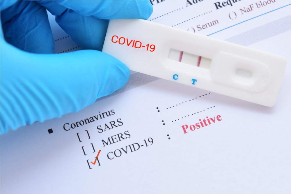 COVID-19. Încă o zi cu peste 6.100 de cazuri noi de infectare. Incidenţa, la Constanţa, în uşoară scădere - covid19test-1617272654.jpg