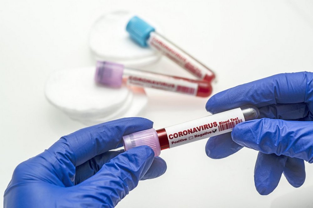 Coronavirus la Constanța. Au fost confirmate 23.917 de persoane au fost confirmate cu COVID - covid3-1608321941.jpg