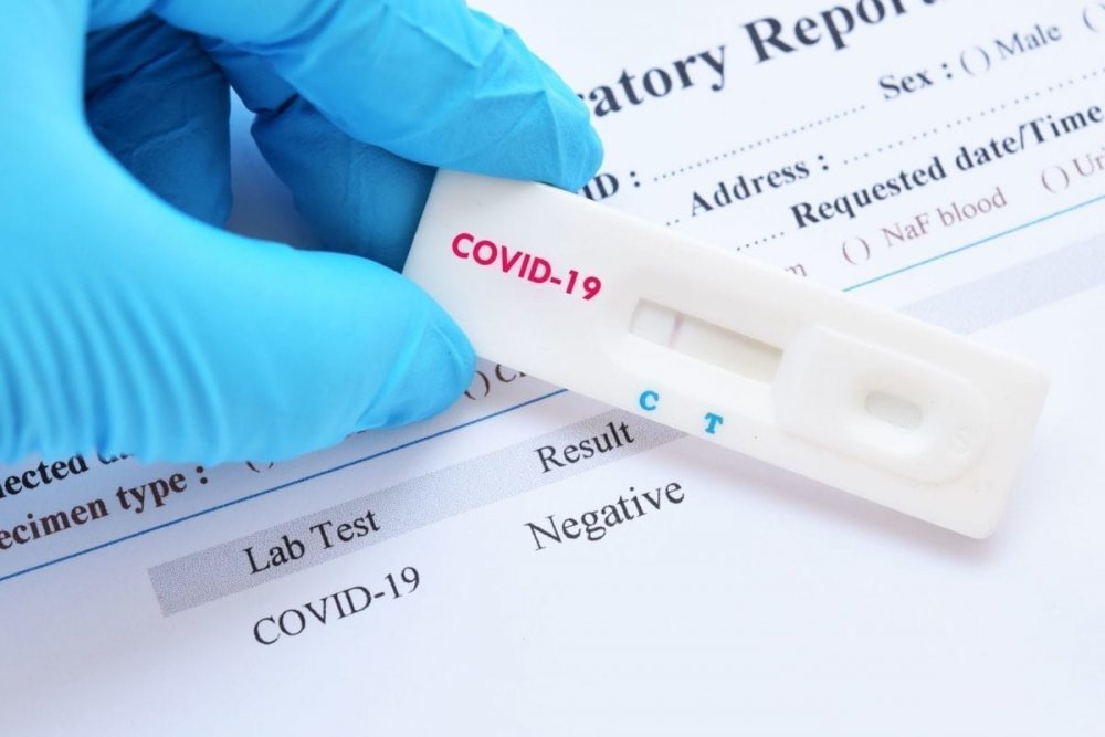 Testarea rapidă în farmacii pentru depistarea COVID-19, aprobată de Ministerul Sănătății - d377302655b44c068221b7b056b9a447-1620719425.jpg