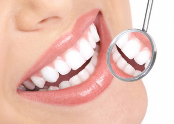 Cum să cureți piatra de pe dinți chiar la tine acasă! E simplu și sănatos! - dintisanatosi1-1418988264.jpg