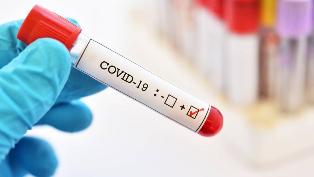 Coronavirus la Constanța. 25.194 de persoane au fost confirmate cu COVID până în prezent - dintre1832depersoanetestatesamba-1608922358.jpg