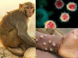„Variola maimuței nu are acelaşi mecanism de răspândire ca la COVID-19 sau la gripă” - download-1653034468.jpg