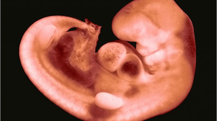 Patriarhia Română se opune finanțării cercetării pe embrioni umani - emb-1368773006.jpg