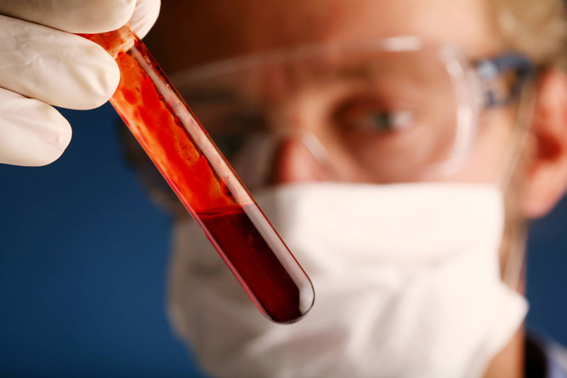 Analizele la sânge îți pot salva viața! Ce este eritrocitoza și cum poate fi depistată - eritrocitoza-1465915939.jpg