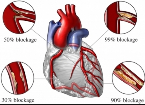 Finanțare europeană pentru cercetare privind bolile cardio-vasculare - finantarecercetareboli-1501671417.jpg