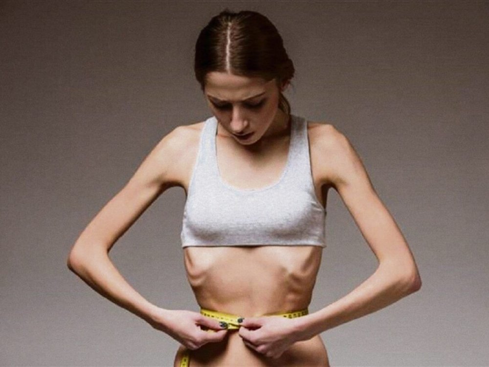 Fuga de mâncare! Atenţie la primele semne de anorexie, la adolescenți - fondanorexia-1652620956.jpg