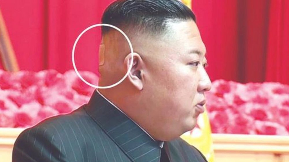 Bandajul de pe ceafa lui Kim Jong Un ridică multe semne de întrebare - fondbun-1628082551.jpg