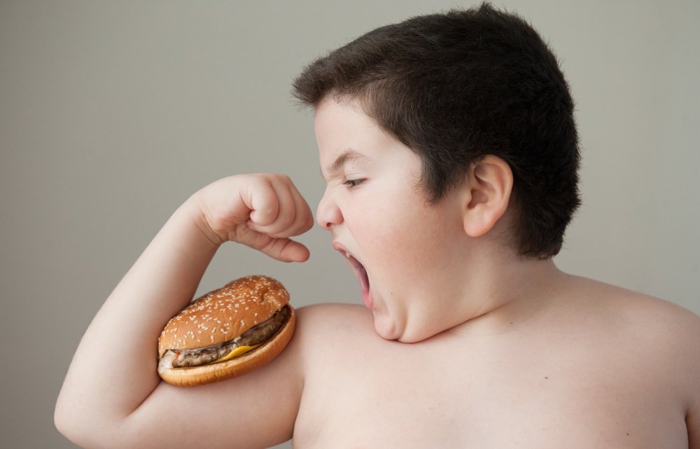 Obezitatea infantilă vă expune micuţii la multe boli - fondobezitatecopii-1668347311.jpg