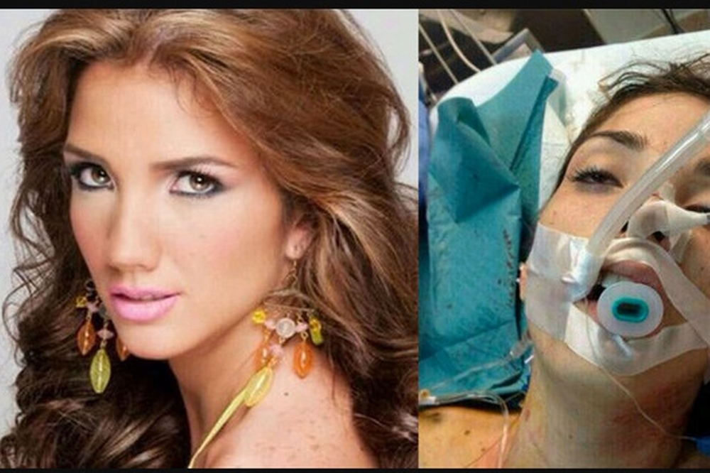 Miss Turism din Venezuela 2013, împușcată mortal în timpul protestelor antiguvernamentale - genesiscarmona3164631-1392901565.jpg