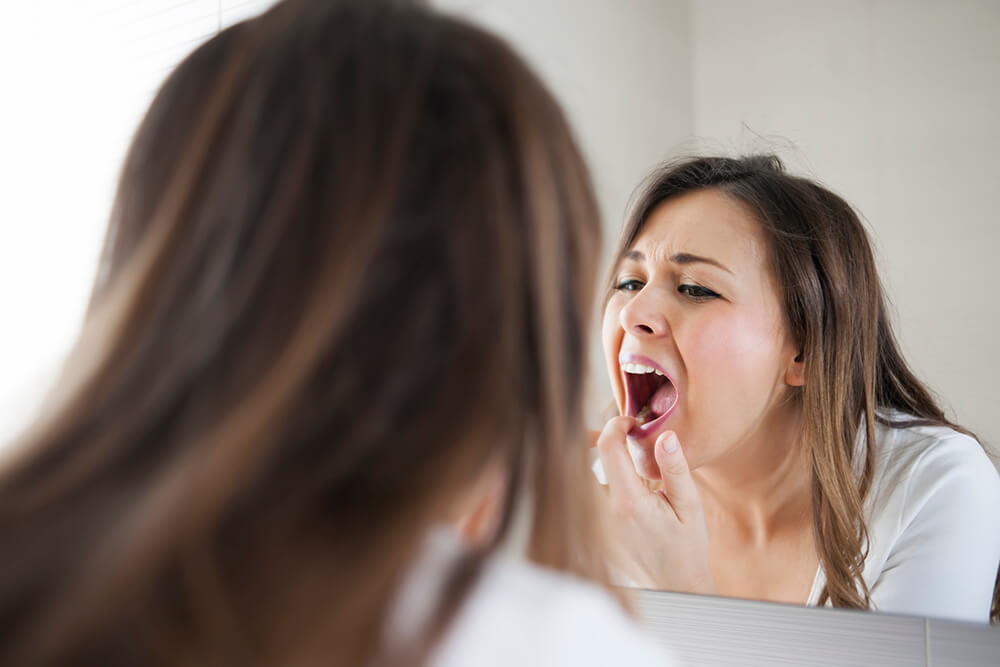 Glandele salivare pot suferi din cauza proceselor tumorale sau inflamatorii - glandelesalivare-1668088316.jpg