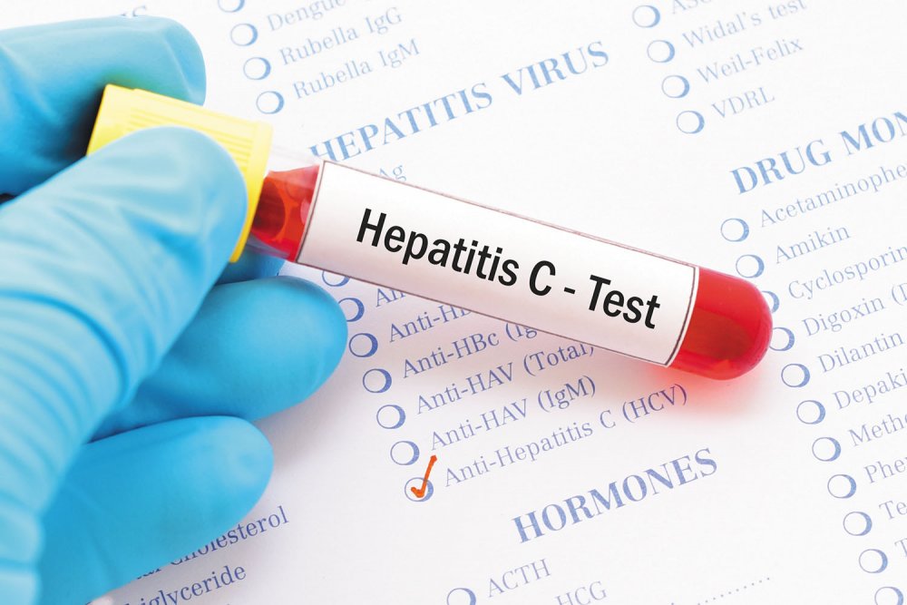 Aproximativ 89.000 de locuitori din zona Dobrogei s-au testat pentru infecțiile cu HIV sau hepatite virale - hepatitac-1627225307.jpg