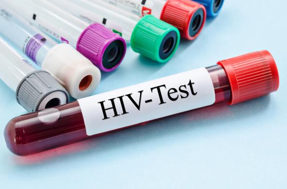 Virusul SIDA a dispărut ca prin minune la o fetiță de nouă ani - hiv-1500911226.jpg