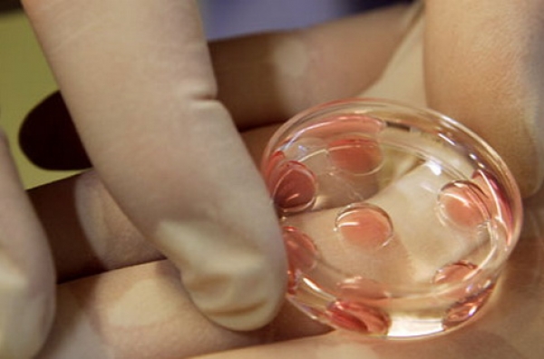 Inseminarea artificială cu ovule donate, aprobată de Guvern - inseminareartificiala-1317325909.jpg