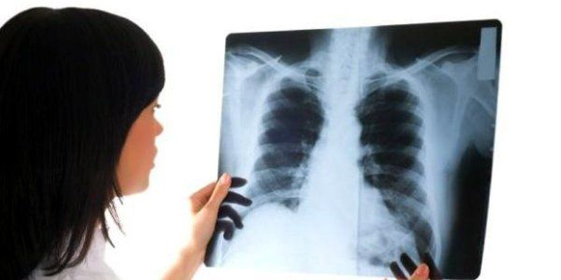 Investigații gratuite pentru depistarea cancerului pulmonar - investigartiicancermedstar-1430051645.jpg