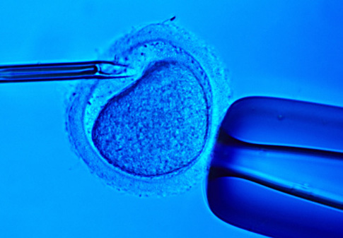 Sute de cupluri beneficiază gratuit de fertilizarea in vitro - invitro-1323789665.jpg