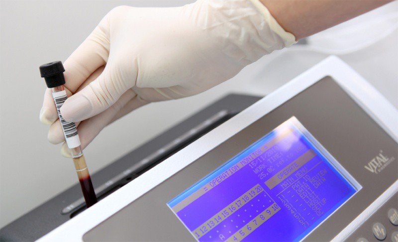 Sânge artificial creat de cercetători clujeni. Rezultate încurajatoare! - laboratoranalize-1382981038.jpg