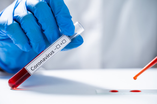 Coronavirus la Constanța. 1.082 de persoane au fost confirmate cu COVID-19 până la ora actuală - laboratoryassistanttestsbloodnew-1596732304.jpg