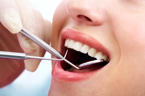 Când ar trebui tratate cariile dentare - mediccarii-1404921709.jpg