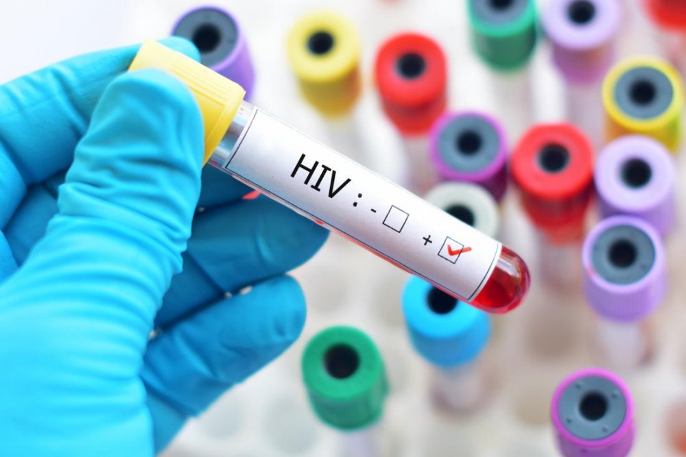 Mii de persoane testate gratuit pentru infecţiile cu HIV sau hepatită - miidepersoanetestate2-1627305509.jpg