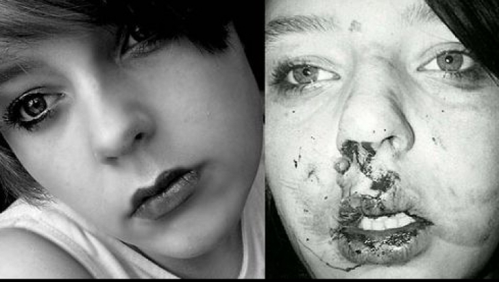 O tânără a fost mutilată de un grup de bătăuși. Află reacția fetei! - mutilata18945400-1353397354.jpg