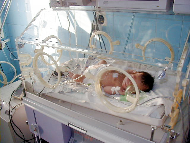 Nașterile premature, tot mai frecvente la Constanța - nasterilepremature-1349882714.jpg