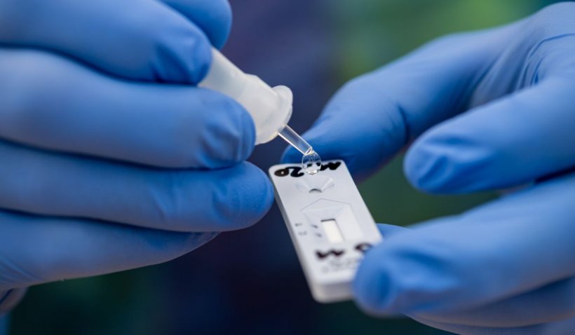 Testul PCR negativ nu exclude infecţia cu COVID-19, concluzia unui centru medical după peste 50.000 de teste - pcr-1634147852.jpg
