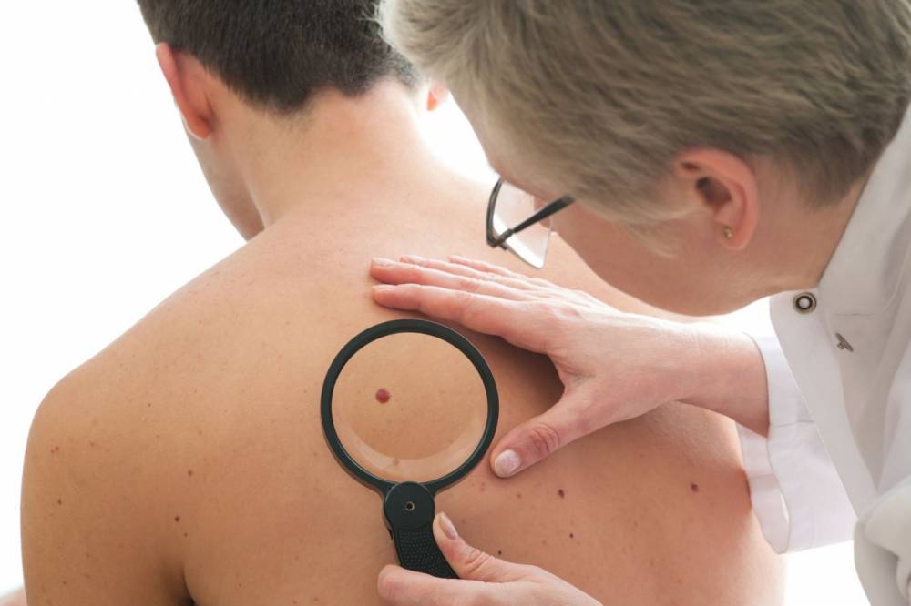 Cancerul de piele face ravagii - piele-1493042617.jpg